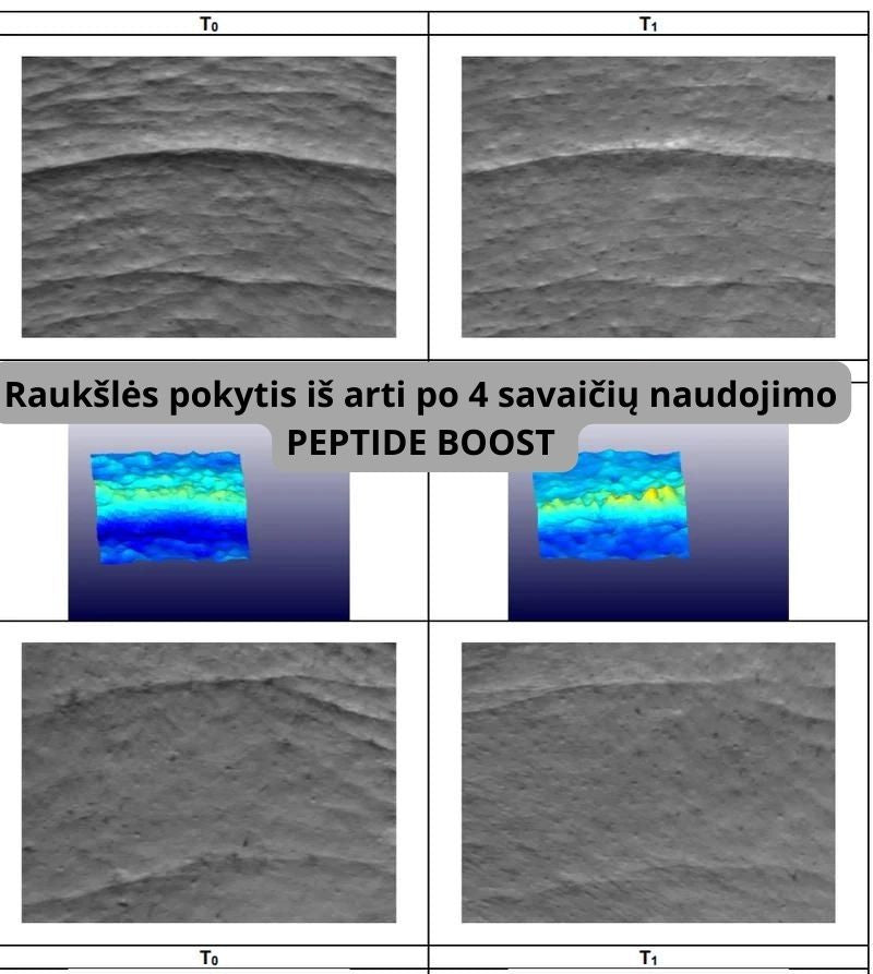 MAXI: A peptide complex for complete skin regeneration