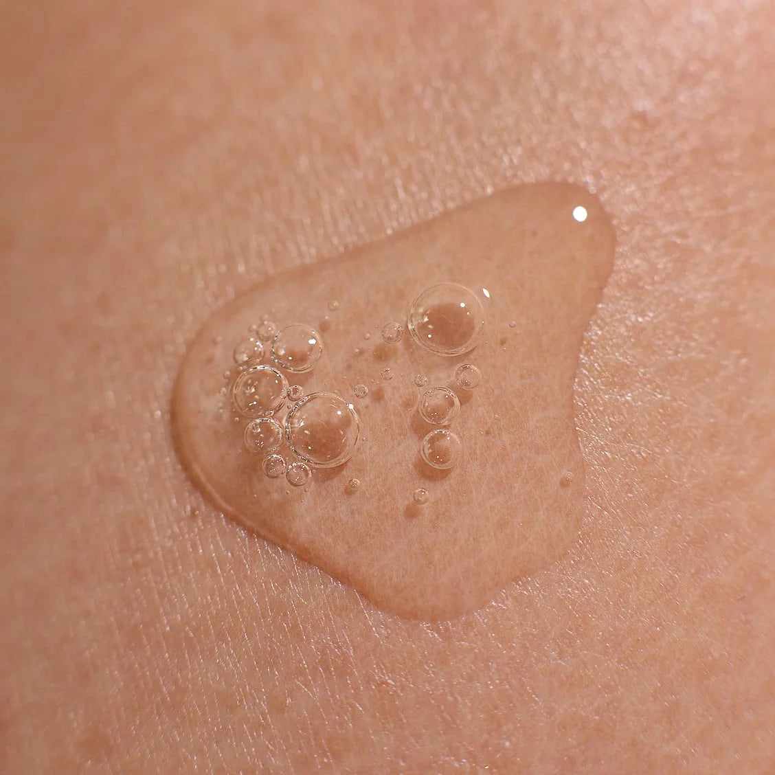 Concentrated serum for sebum control and pore-reduction "Niacinamide+"