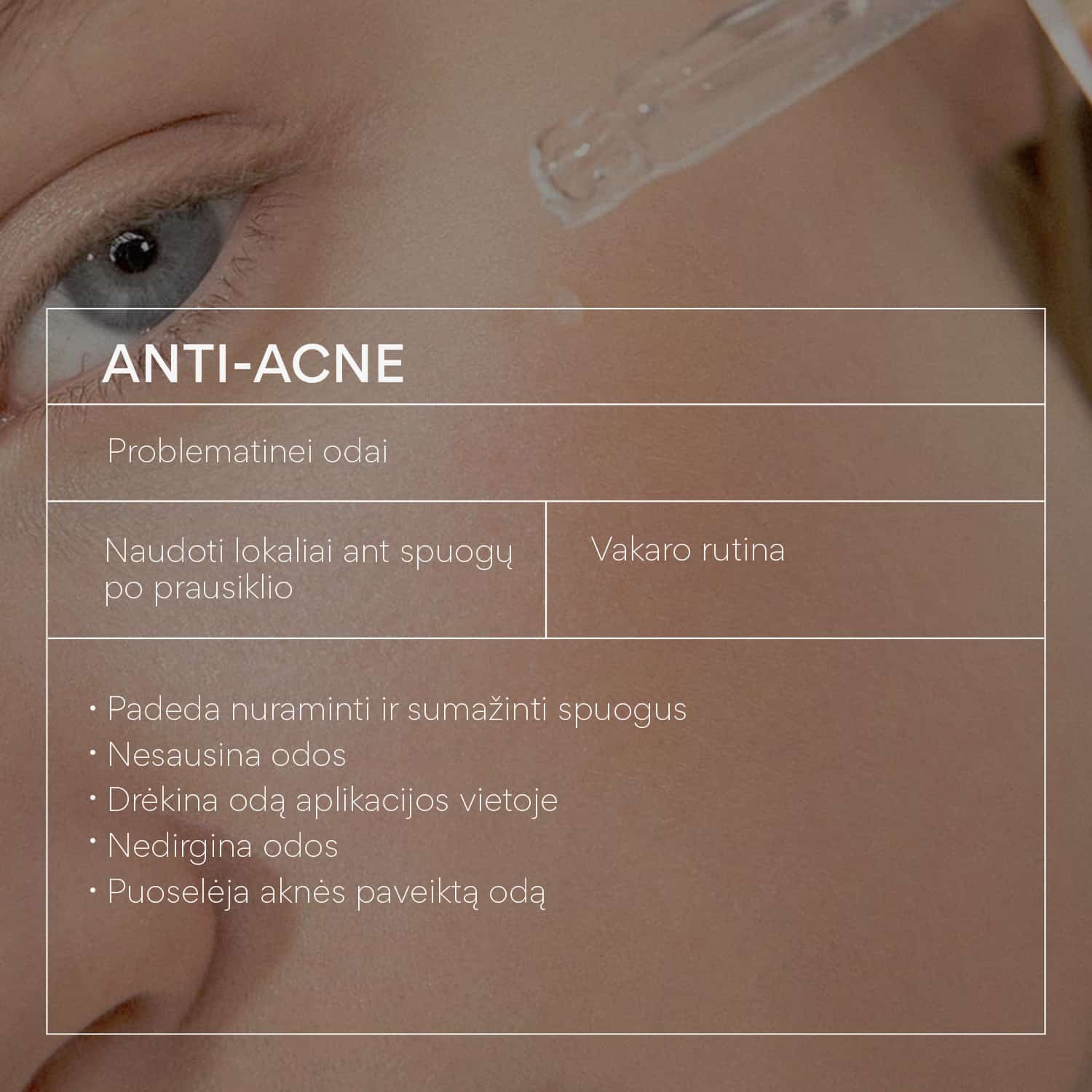 SOS First Aid for Acne: ANTI-ACNE GEL