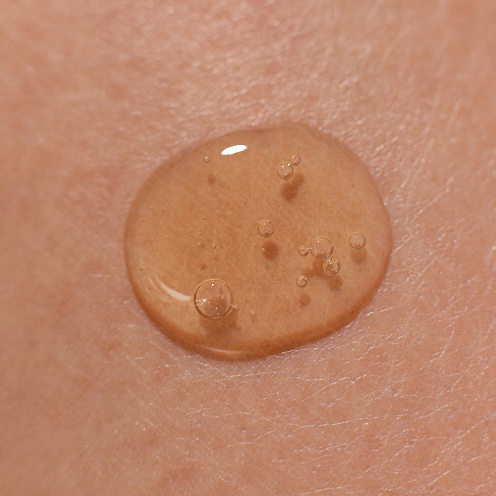 Toning Serum for Acne Prevention SKIN BALANCE